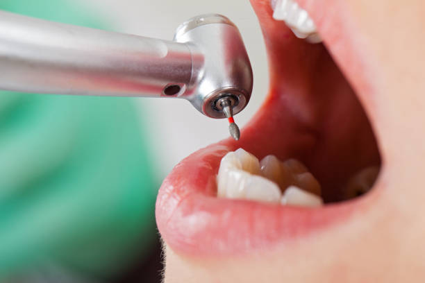 Best Emergency Treatment for Toothache in Centralia, IL